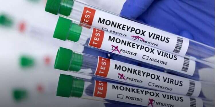 UN health agency declares monkeypox a global emergency