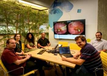 Sheba's new AI-based algorithm, powered by Intel hardware, can scan 10,000-12,000 images of digestive system in two minutes Sheba, Intel hope to give Crohn's disease a punch in the gut using AI