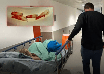 5-year-old hospitalized after being hit by electric bike