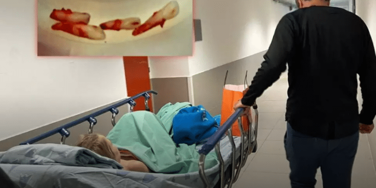 5-year-old hospitalized after being hit by electric bike