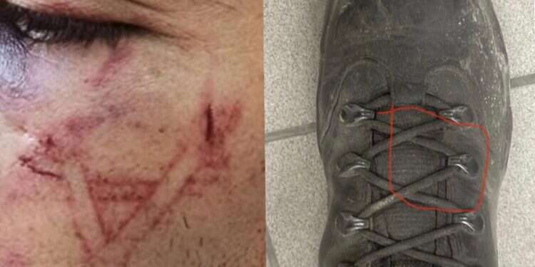 Police deny imprinting Star of David on Palestinian arrestee's face