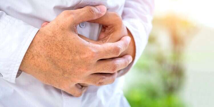 This new approach to personalized care for patients undergoing gastrointestinal surgery is intended to enhance surgical outcomes and reduce hospital costs Exero Medical clinical study of xBar approved by WCG