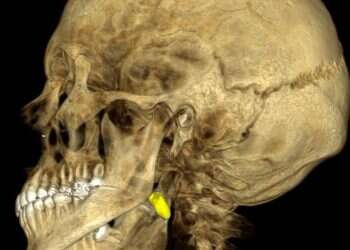 Reservist's rare injury sparks medical dilemma