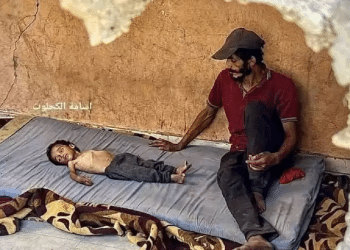 Hamas exploits children with genetic diseases for 'starvation campaign'