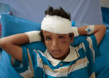 The famine no one talks about