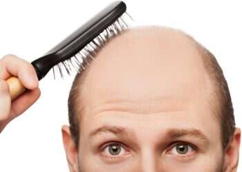 The primary driver of male pattern baldness is genetic factors that render an individual's hair follicles overly sensitive to androgens Clinical trials reveal 539% hair regrowth from new drug