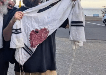A prayer shawl belonging to one of the attendees, stained with blood Sydney terror attack leaves Australian Jews feeling abandoned by government