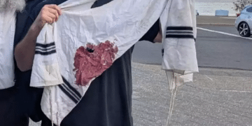 A prayer shawl belonging to one of the attendees, stained with blood Sydney terror attack leaves Australian Jews feeling abandoned by government
