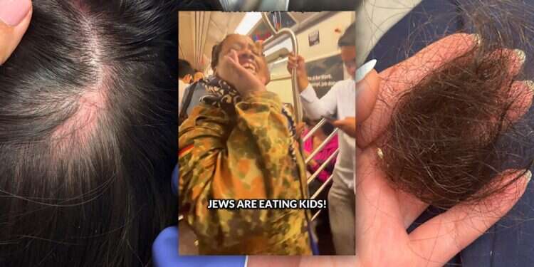 Jewish nurse choked on NYC subway as attacker shouts 'Jews are eating kids'